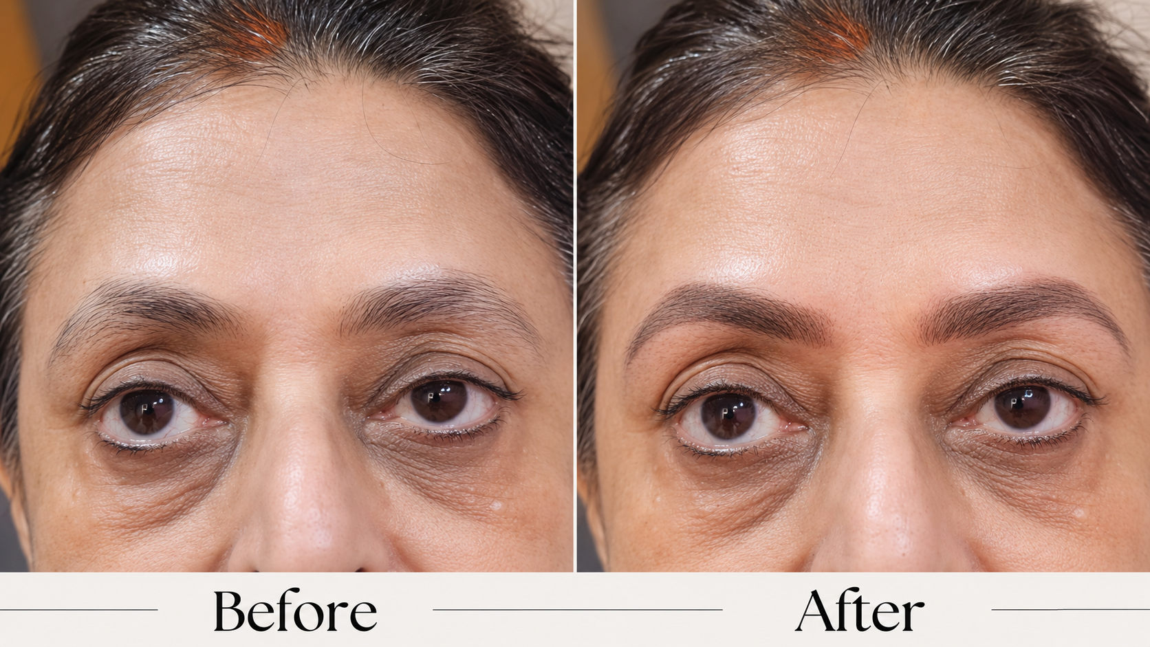 Combination Brows before and after — client 11